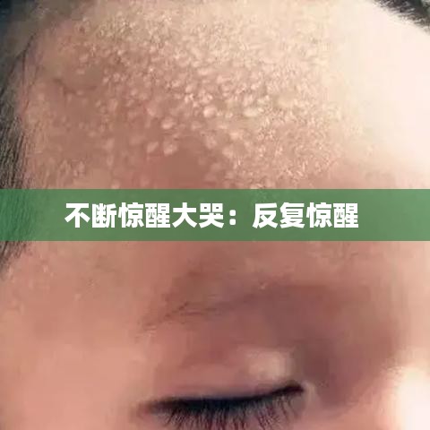 不断惊醒大哭：反复惊醒 