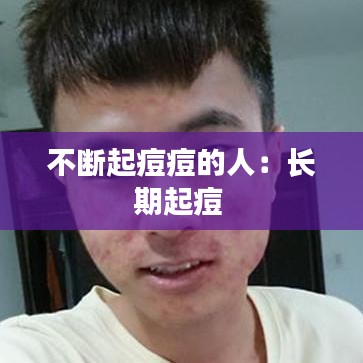 不断起痘痘的人：长期起痘 