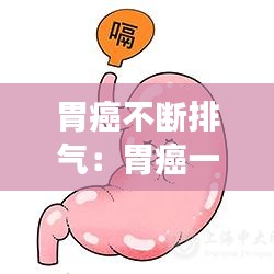 胃癌不断排气：胃癌一直放屁吗 